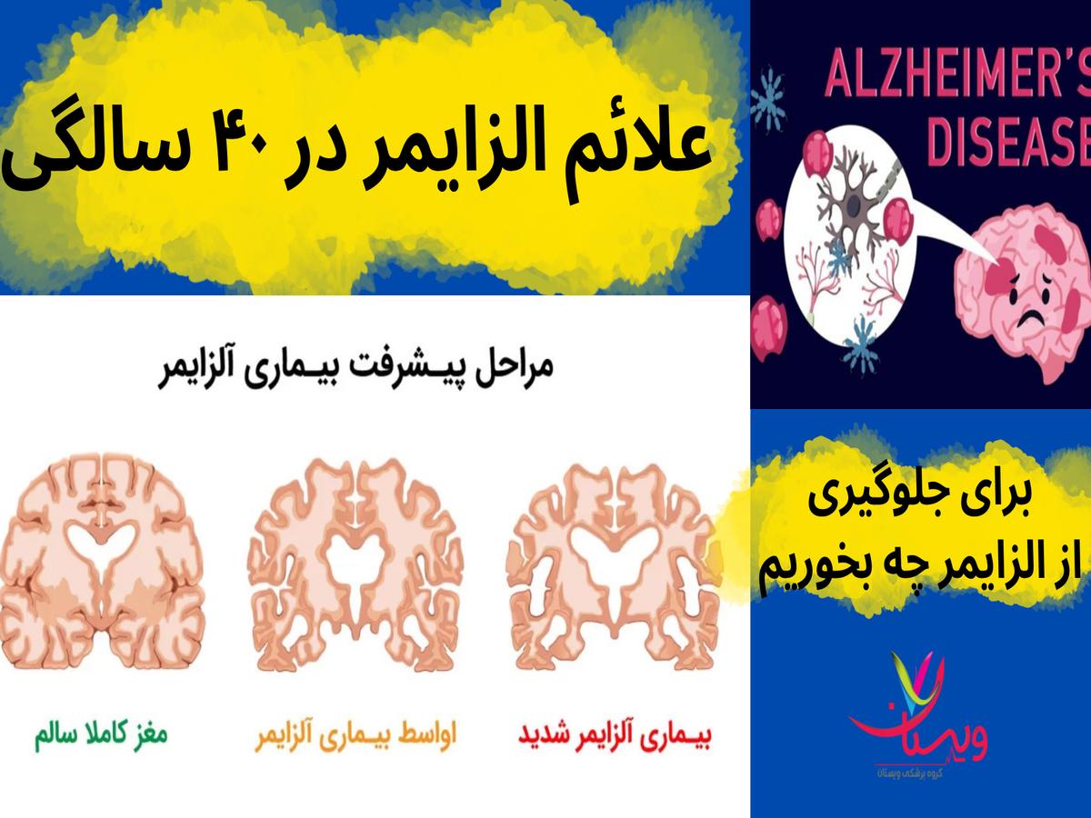 با آزمایش شبکیه چشم می‌توان آلزایمر را تشخیص داد